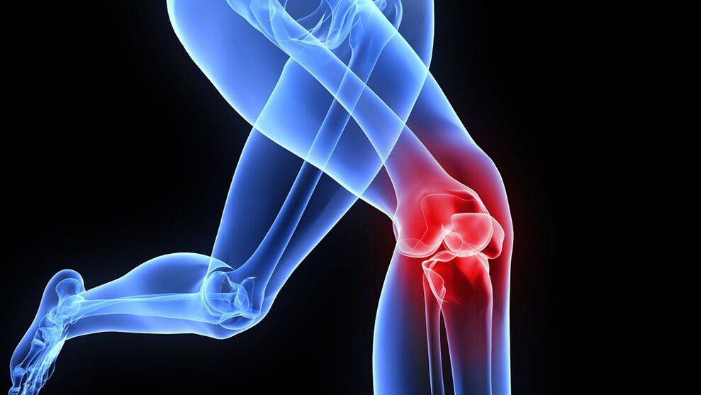 kelio problemos dėl artrozės